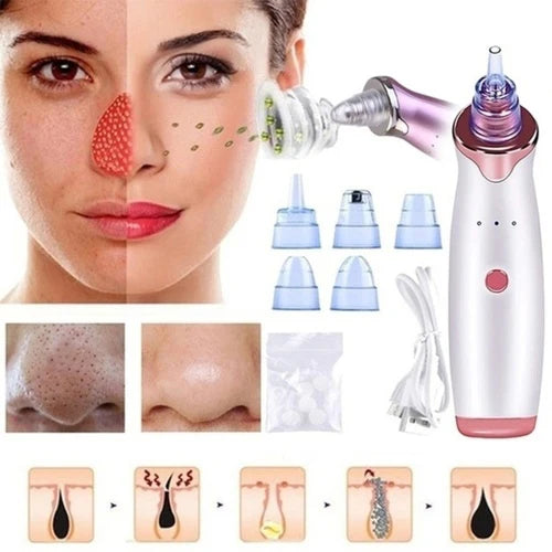 "GlowSkin™ Portable Blackhead Remover"